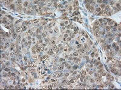 Immunohistochemistry: Glucose 6 phosphate isomerase Antibody (OTI2D2) - Azide and BSA Free [NBP2-70844]