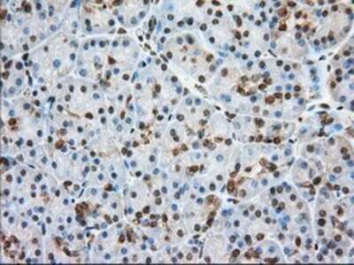 Immunohistochemistry: Glucose 6 phosphate isomerase Antibody (OTI2D2) - Azide and BSA Free [NBP2-70844]