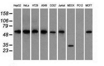 Western Blot: Glucose 6 phosphate isomerase Antibody (OTI2D2)Azide and BSA Free [NBP2-70844]