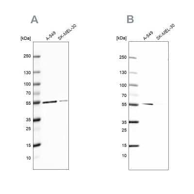 Western Blot: Glucose 6 phosphate isomerase Antibody [NBP1-90177]