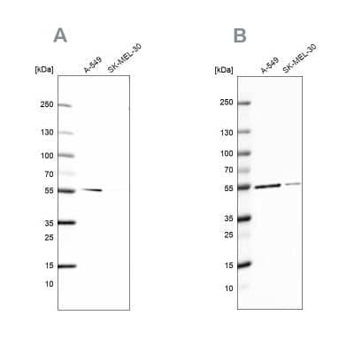 Western Blot: Glucose 6 phosphate isomerase Antibody [NBP2-58524]