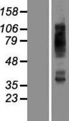 Western Blot: Glut4 Overexpression Lysate [NBP2-10895]