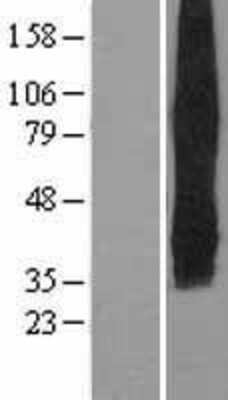 Western Blot: Glut5 Overexpression Lysate [NBL1-16101]