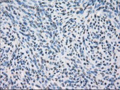 Immunohistochemistry-Paraffin: Glucose Transporter GLUT6 Antibody (OTI7E3) [NBP1-47987]