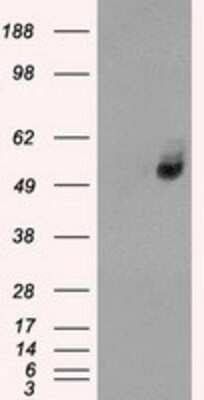 Western Blot: Glucose Transporter GLUT6 Antibody (OTI7E3) [NBP1-47987]