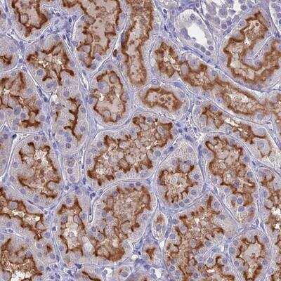 Immunohistochemistry: Glucose Transporter GLUT6 Antibody [NBP2-13327]