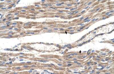 Immunohistochemistry-Paraffin: Glucose Transporter GLUT6 Antibody [NBP1-59891]