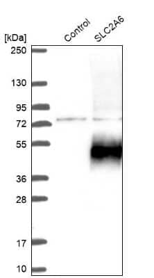 Western Blot: Glucose Transporter GLUT6 Antibody [NBP2-13327]