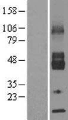 Western Blot: Glucose Transporter GLUT6 Overexpression Lysate [NBL1-16102]