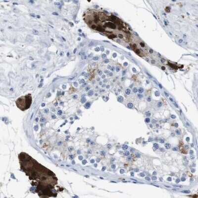 Immunohistochemistry-Paraffin: Glucose Transporter GLUT8 Antibody [NBP1-89760]