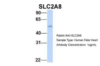 Western Blot: Glucose Transporter GLUT8 Antibody [NBP1-59812]