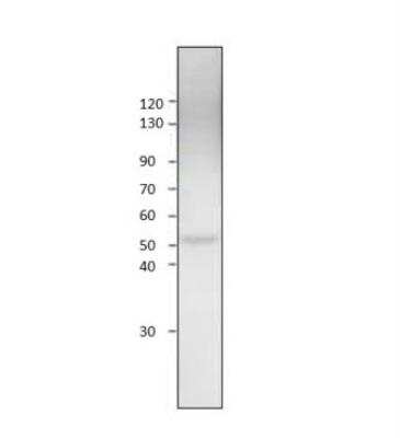 Western Blot: Glucose Transporter GLUT8 Antibody [NBP3-12470]