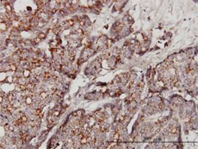 Immunohistochemistry-Paraffin: Glucosylceramidase/GBA Antibody (2E2) [H00002629-M01]