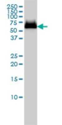 Western Blot: Glucosylceramidase/GBA Antibody (2E2) [H00002629-M01]