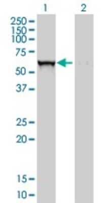 Western Blot: Glucosylceramidase/GBA Antibody (2E2) [H00002629-M01]