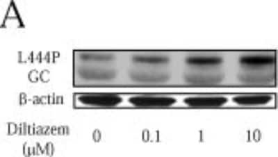 Western Blot: Glucosylceramidase/GBA Antibody (2E2) [H00002629-M01]