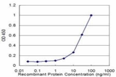 ELISA: Glucosylceramidase/GBA Antibody (2H4) [H00002629-M03]