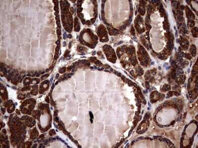 Immunohistochemistry: Glucosylceramidase/GBA Antibody (OTI4G4) [NBP2-45829]