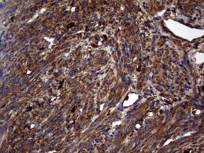 Immunohistochemistry: Glucosylceramidase/GBA Antibody (OTI4G4) [NBP2-45829]