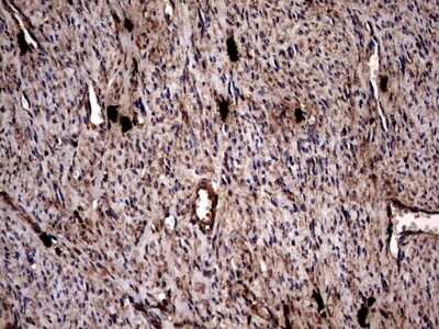 Immunohistochemistry: Glucosylceramidase/GBA Antibody (OTI4G4) [NBP2-45829]