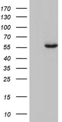 Western Blot: Glucosylceramidase/GBA Antibody (OTI4G4) [NBP2-45829]