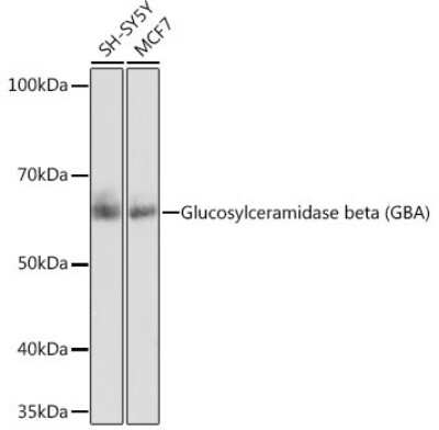 Western Blot: Glucosylceramidase/GBA Antibody (8O3Z7) [NBP3-15637]