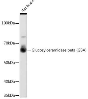 Western Blot: Glucosylceramidase/GBA Antibody (8O3Z7) [NBP3-15637]