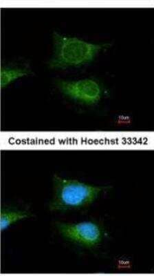 Immunocytochemistry/ Immunofluorescence: Glucosylceramidase/GBA Antibody [NBP1-32271]