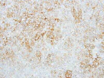 Immunohistochemistry-Paraffin: Glucosylceramidase/GBA Antibody [NBP1-32271]