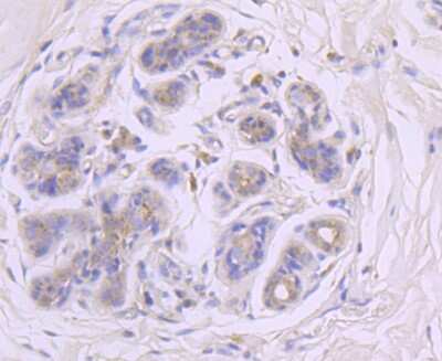 Immunohistochemistry-Paraffin: Glucosylceramidase/GBA Antibody (JM10-76) [NBP2-66871]