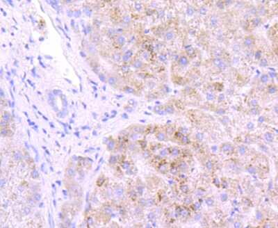 Immunohistochemistry-Paraffin: Glucosylceramidase/GBA Antibody (JM10-76) [NBP2-66871]