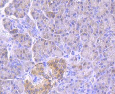 Immunohistochemistry-Paraffin: Glucosylceramidase/GBA Antibody (JM10-76) [NBP2-66871]