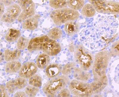 Immunohistochemistry-Paraffin: Glucosylceramidase/GBA Antibody (JM10-76) [NBP2-66871]