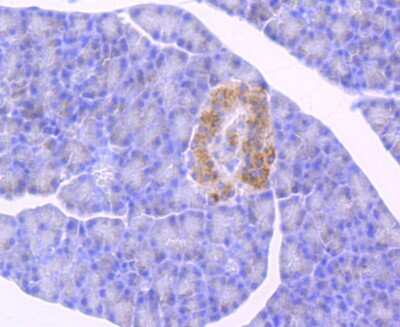 Immunohistochemistry-Paraffin: Glucosylceramidase/GBA Antibody (JM10-76) [NBP2-66871]