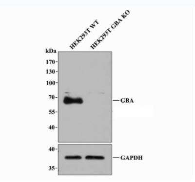 Western Blot: Glucosylceramidase/GBA Antibody (JM10-76) [NBP2-66871]