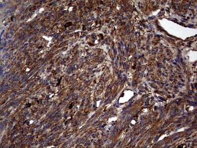 Immunohistochemistry: Glucosylceramidase/GBA Antibody (OTI4G4) - Azide and BSA Free [NBP2-70803]
