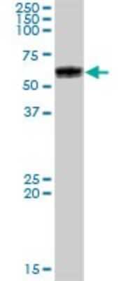 Western Blot: Glucosylceramidase/GBA Antibody [H00002629-B01P]