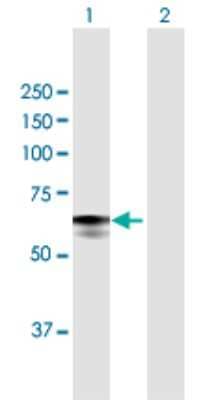 Western Blot: Glucosylceramidase/GBA Antibody [H00002629-B01P]