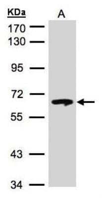Western Blot: Glucosylceramidase/GBA Antibody [NBP1-32271]