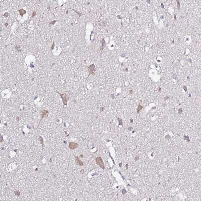 Immunohistochemistry-Paraffin: Glucuronic Acid Epimerase Antibody [NBP2-31872]