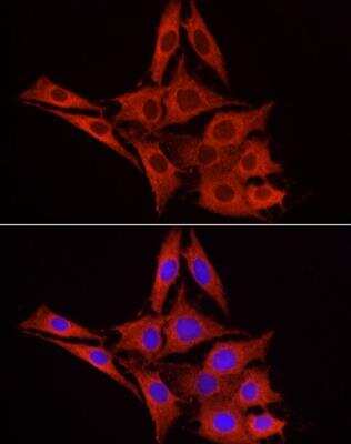Immunocytochemistry/ Immunofluorescence: Glucuronosyltransferase 1A1/UGT1A1 Antibody - Azide and BSA Free [NBP3-03338]