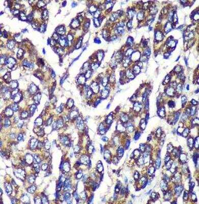 Immunohistochemistry-Paraffin: Glucuronosyltransferase 1A1/UGT1A1 Antibody - Azide and BSA Free [NBP3-03338]