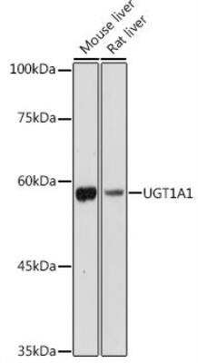 Western Blot: Glucuronosyltransferase 1A1/UGT1A1 AntibodyAzide and BSA Free [NBP3-03337]