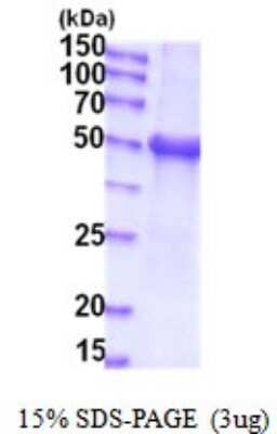 SDS-PAGE: Recombinant Human Glucuronosyltransferase 1A1/UGT1A1 His Protein [NBP2-52019]