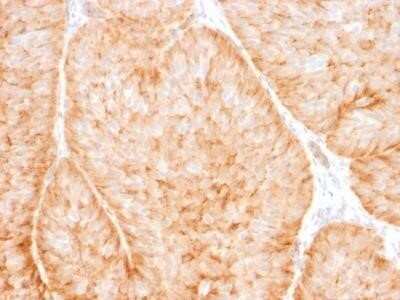 Immunohistochemistry-Paraffin: Glut1 Antibody (GLUT1/2475) - Azide and BSA Free [NBP2-75786]