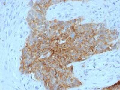 Immunohistochemistry-Paraffin: Glut1 Antibody (GLUT1/2475) - Azide and BSA Free [NBP2-75786]