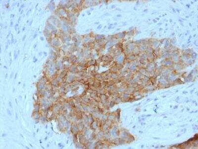 Immunohistochemistry-Paraffin: Glut1 Antibody (GLUT1/2475) [NBP2-75784]