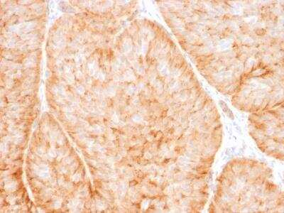Immunohistochemistry-Paraffin: Glut1 Antibody (GLUT1/2475) [NBP2-75784]