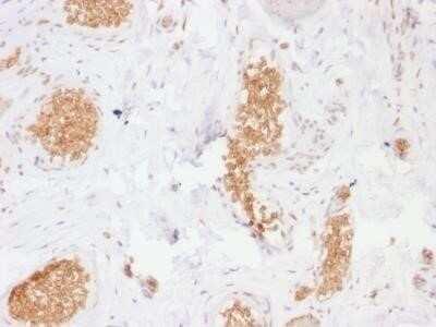 Immunohistochemistry-Paraffin: Glut1 Antibody (GLUT1/2476) - Azide and BSA Free [NBP2-75787]