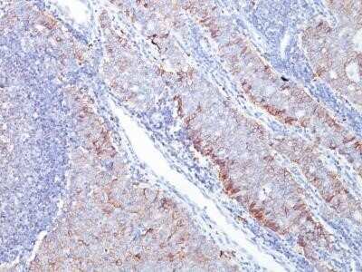 Immunohistochemistry-Paraffin: Glut1 Antibody (GLUT1/2476) - Azide and BSA Free [NBP2-75787]